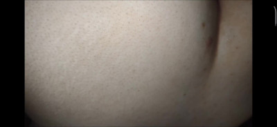 Sexo anal
